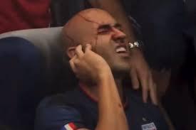 Acusado de apedrejar ônibus em São Paulo é preso; passageira foi atingida no rosto