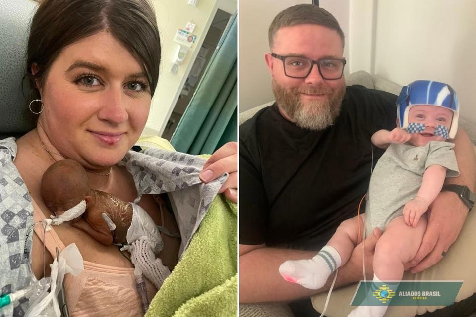 Bebê mais prematuro do mundo, que nasceu com 24 cm, completa 1 ano