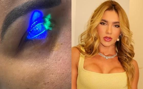 Mulher diz ter ficado cega após usar produto de Virginia Fonseca; WePink se pronuncia