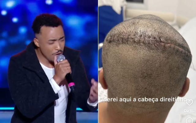 Ex-cantor do Raul Gil descobre tumor cerebral e é operado