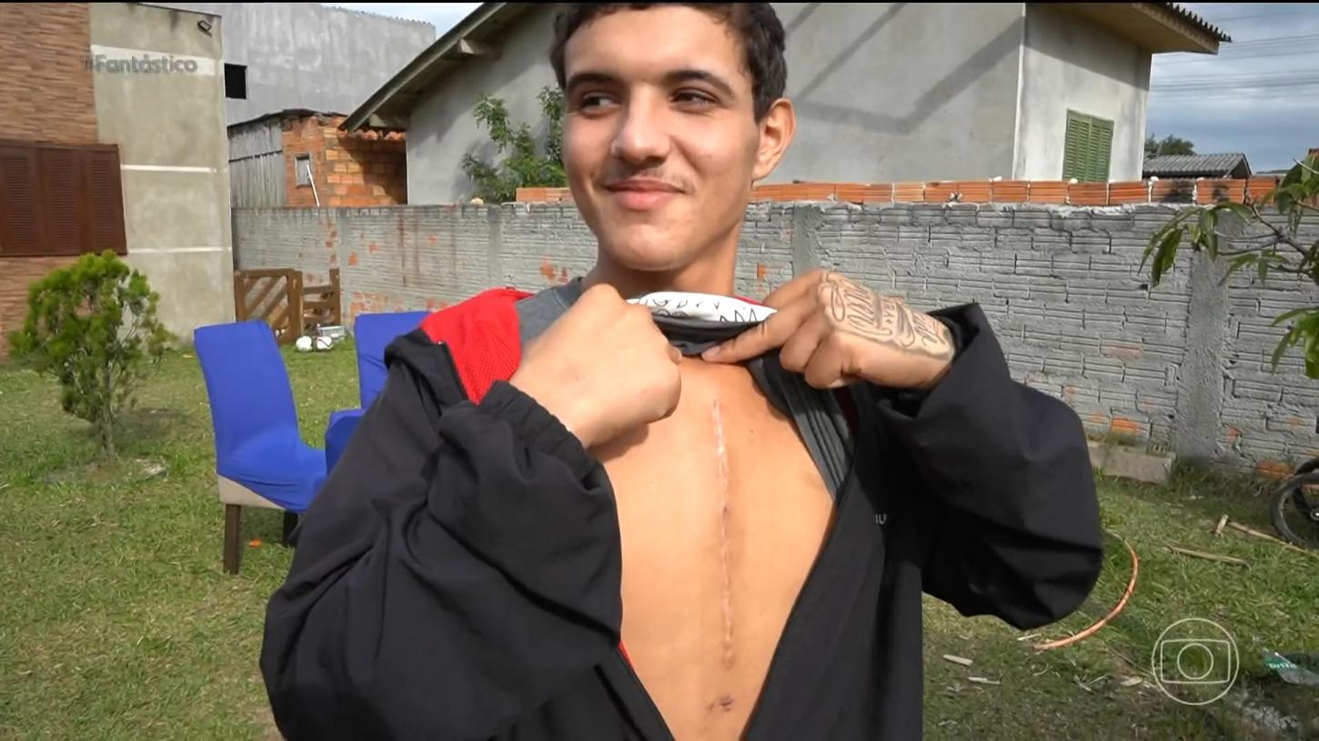 Jovem sobrevive à cirurgia para retirar prego cravado no coração: 'Nasci de novo'
