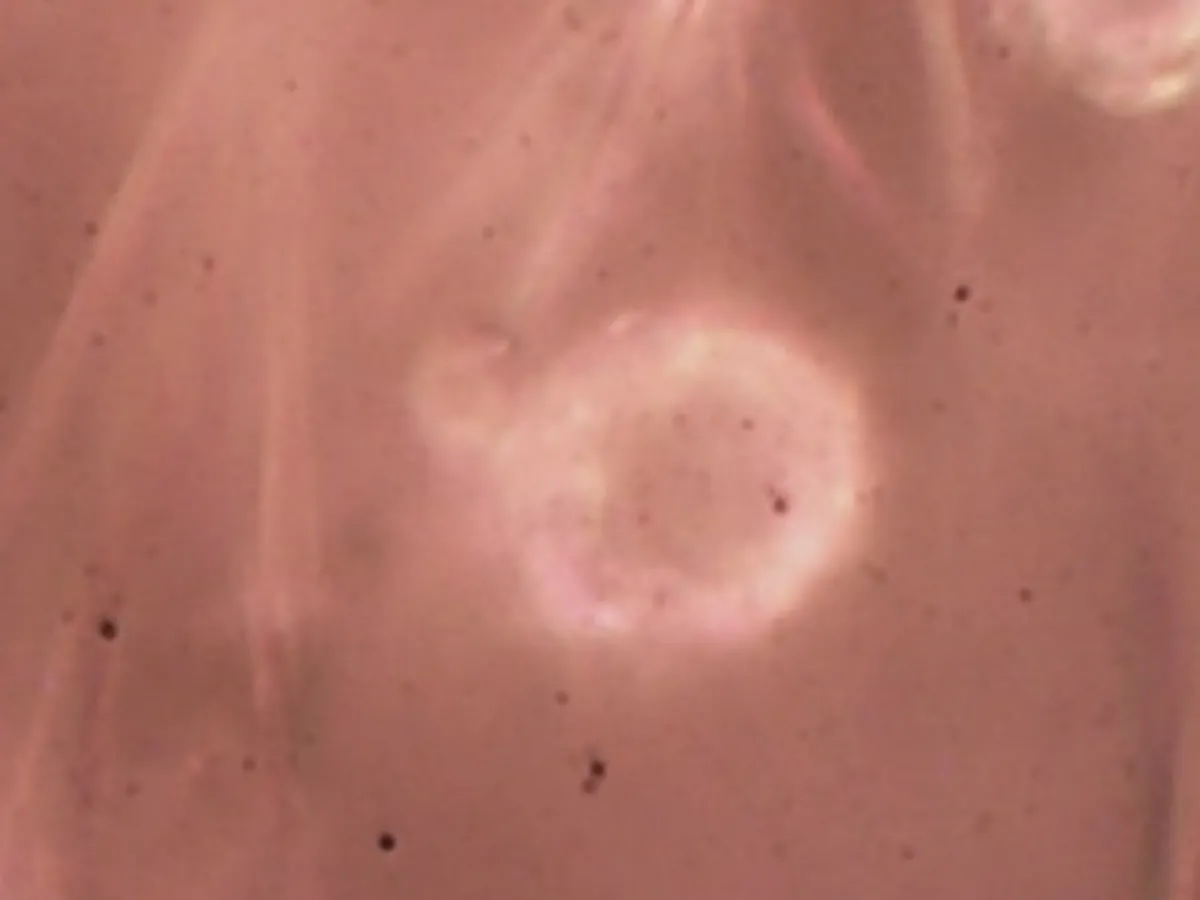 Pela 1ª vez no Brasil, cientistas acham microplástico em cordão umbilical