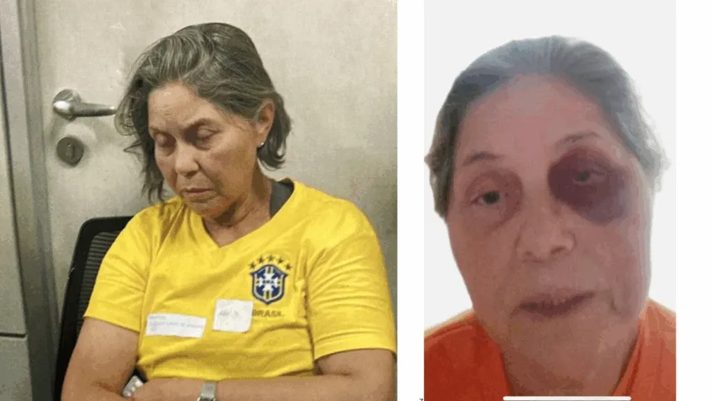 Tortura e agressão contra idosa do 8/1 é protocolada na OEA