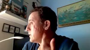 A impressionante história do mexicano que sobreviveu a mordida de tubarão na cabeça