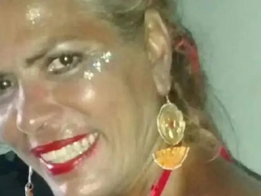 Ex-chacrete morre após ataque de pitbull do filho