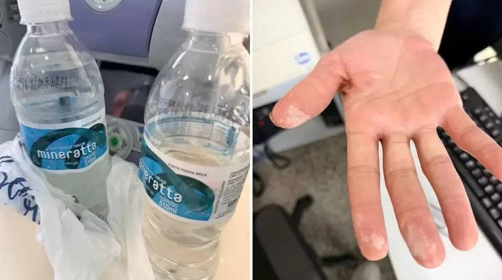 Laudo detecta ácido em garrafas de água após internação em SP