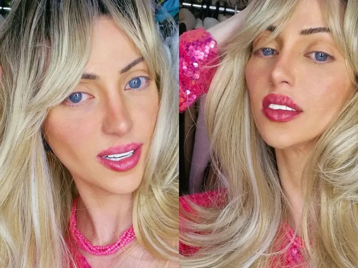 'Barbie humana': influencer teve morte acidental por overdose de cocaína, apontam IML e polícia