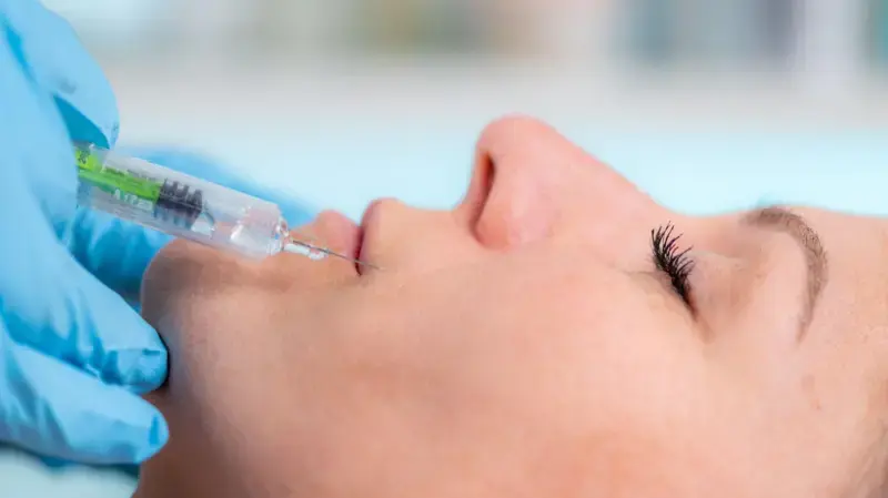 O novo alerta sobre perigos da harmonização facial e outros preenchimentos — e como se proteger