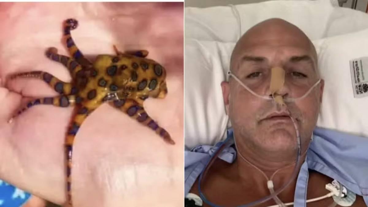 Banhista sofre paralisia total após picada de polvo-de-anéis-azuis