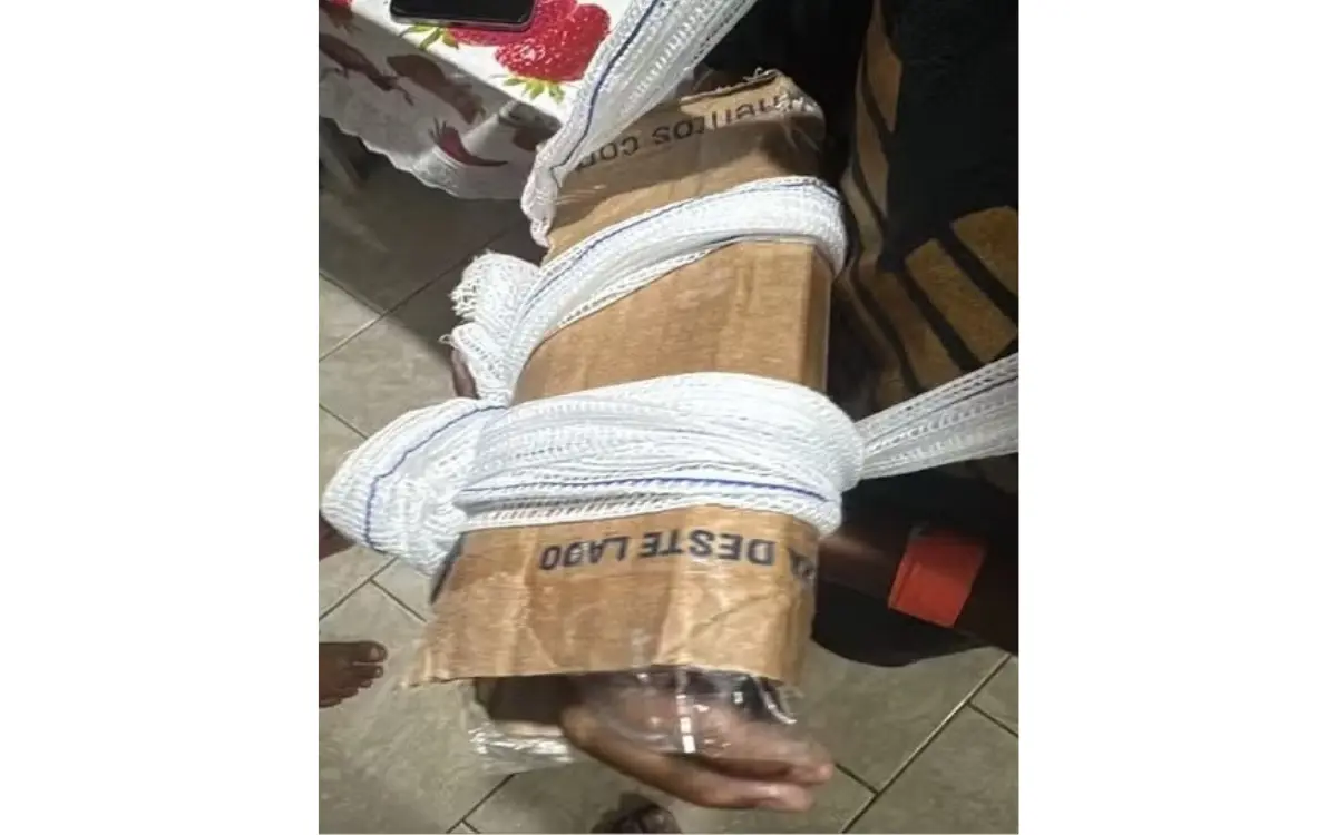 Criança quebra braço e sai da UPA com imobilização improvisada de papelão em São Pedro da Aldeia