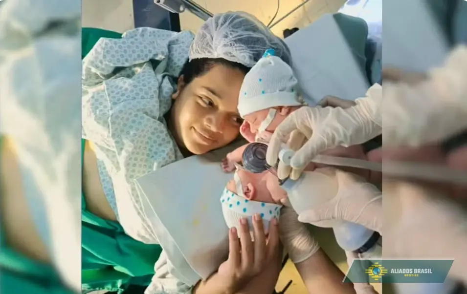 Gêmeos siameses recém-nascidos morrem em Goiás após cirurgias