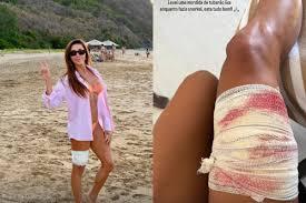 Mergulhador bate em tubarão antes de turista ser mordida em Fernando de Noronha; VÍDEO