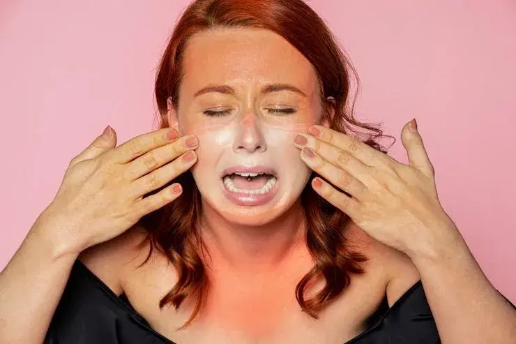 Queimadura de sol? Dermatologista explica quais produtos ajudam a salvar sua pele