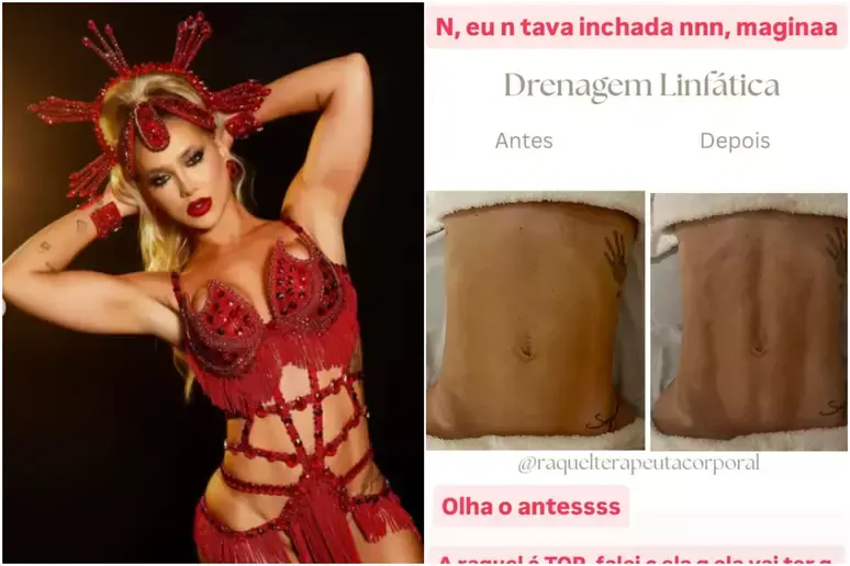 Virginia impressiona com antes e depois após drenagem linfática; conheça os benefícios 