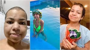 Após bariátrica, jovem tem quadro raro, passa meses na UTI e reverte cirurgia que causou desnutrição