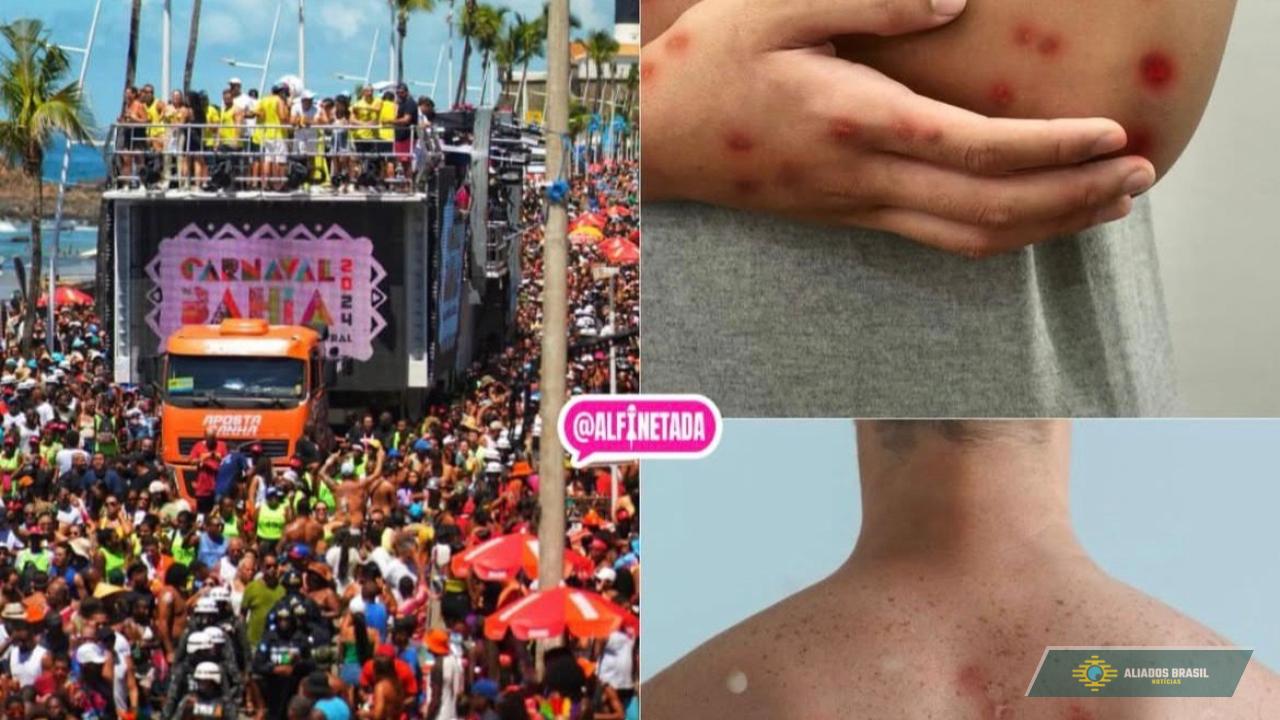 Mpox na Bahia está deixando autoridades em alerta