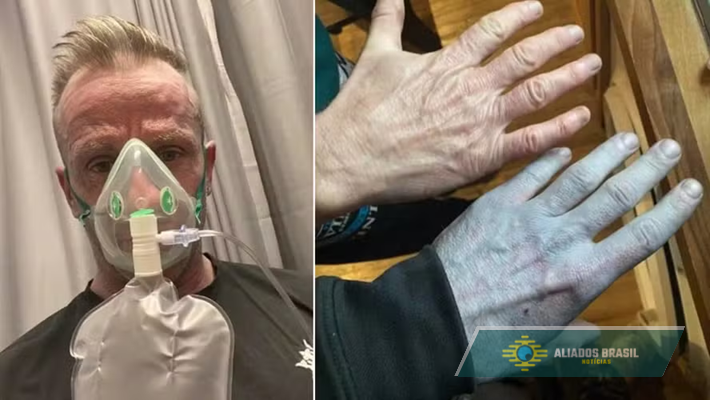 Homem acorda com partes do corpo azuladas, corre para hospital e se surpreende com diagnóstico