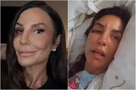Ivete Sangalo revela que passará por cirurgia neste domingo