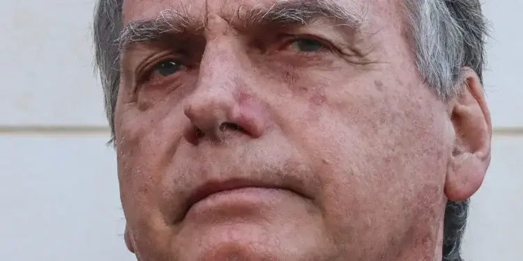 Quadro de pneumonia de Bolsonaro é “grave”, diz médico