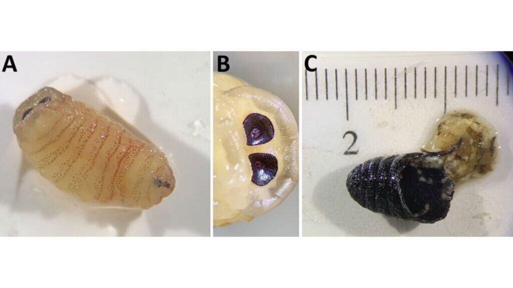 Com infecção rara, mulher espirra larvas e pupa de mosca