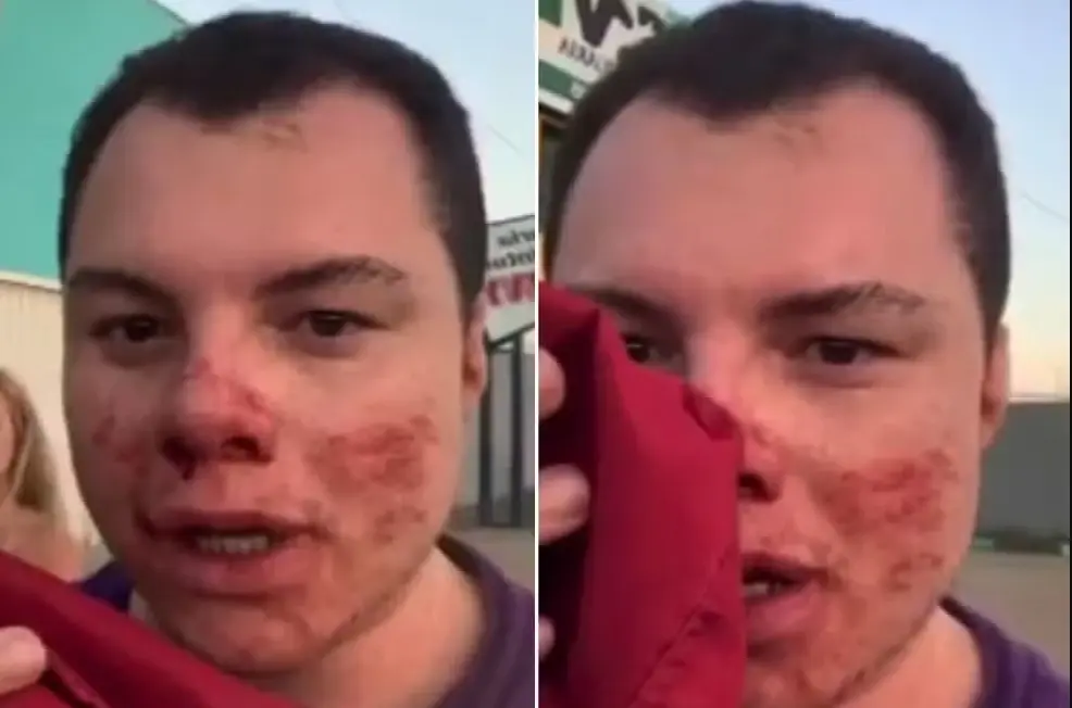 Influenciador é internado em UTI após ser agredido em universidade