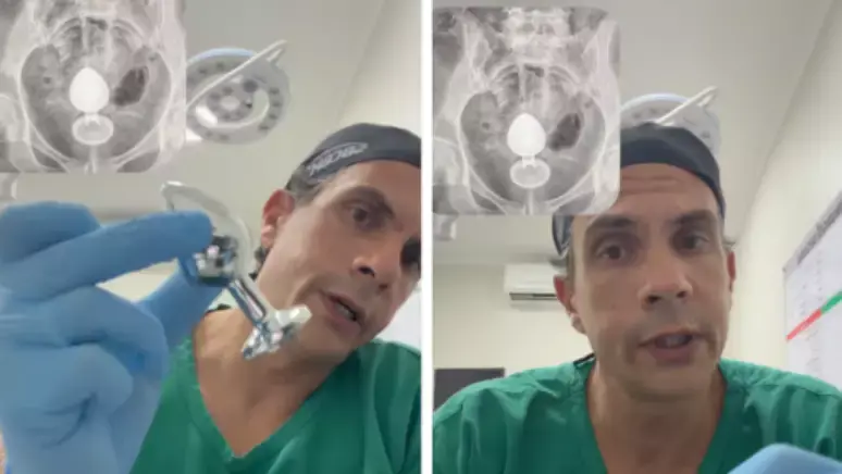 Médico alerta sobre cuidados com plug anal após mulher ficar com brinquedo preso no intestino  