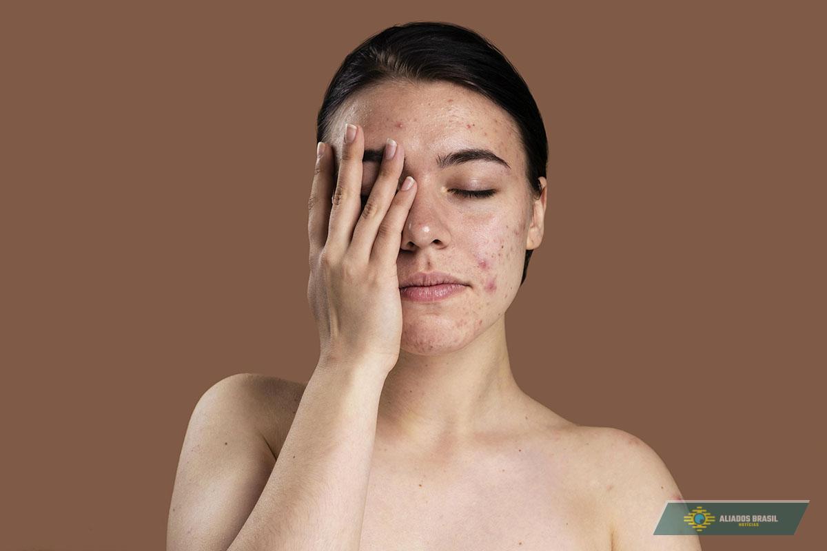 4 sinais visíveis no rosto que indicam disfunção tireoidiana e desequilíbrio hormonal