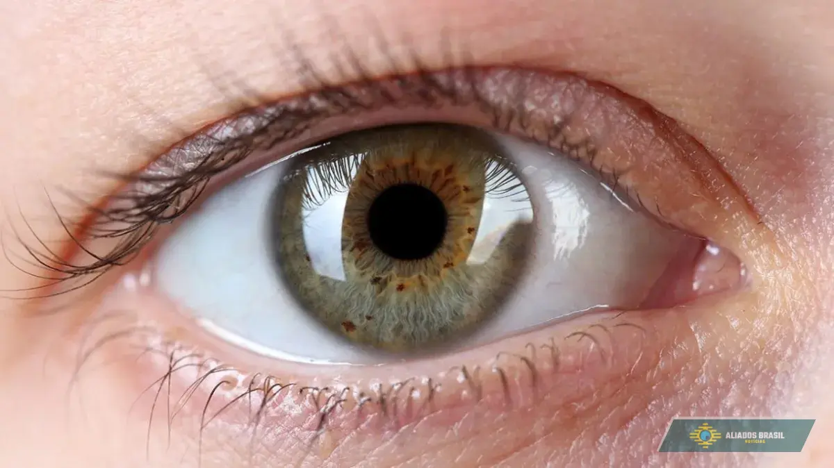 Glaucoma: o perigo que rouba a visão sem avisar e ainda pode ser evitado