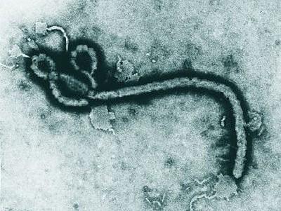 São Paulo investiga caso suspeito de Ebola em homem de 37 anos