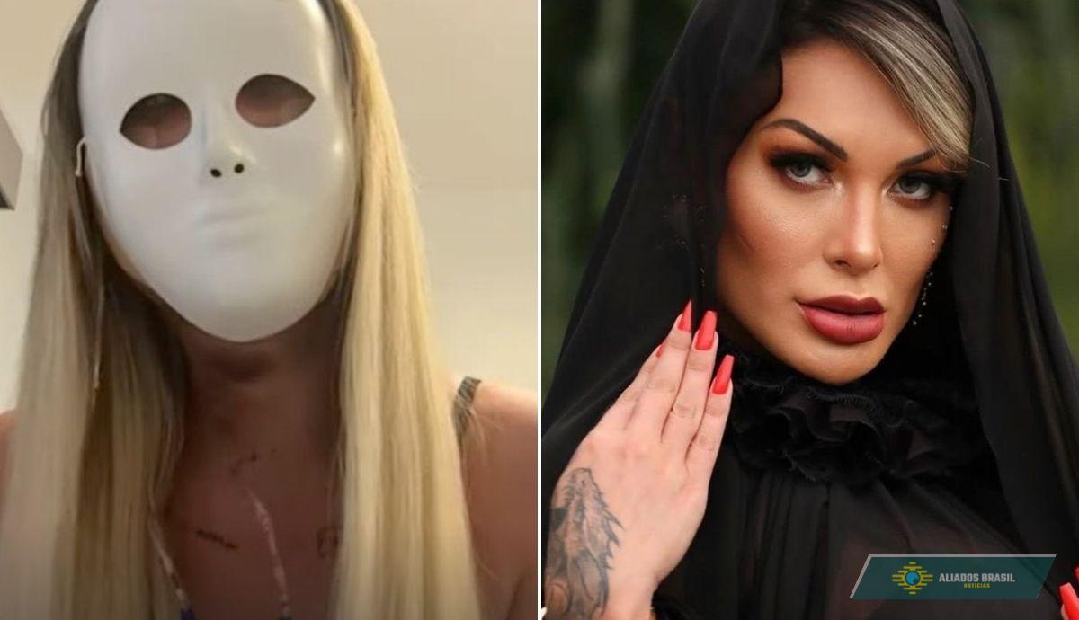 ‘Vou voltar a ter 23 anos’: Andressa Urach faz cirurgia radical para mudar musculatura do rosto