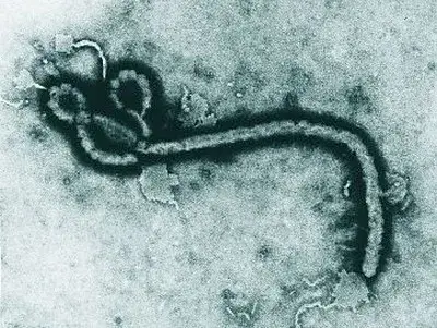 Caso suspeito de Ebola é investigado no RS