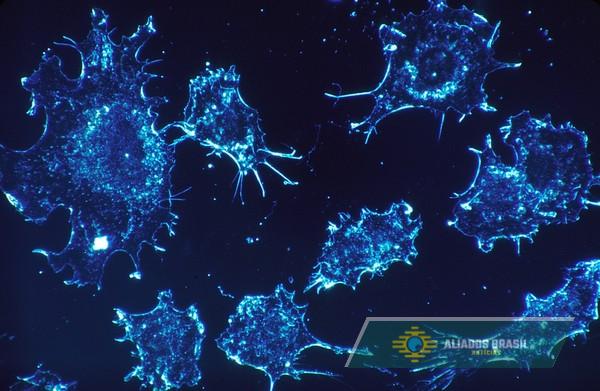 Cientistas franceses criam anticorpo que combate a resistência do câncer de pâncreas à quimioterapia 