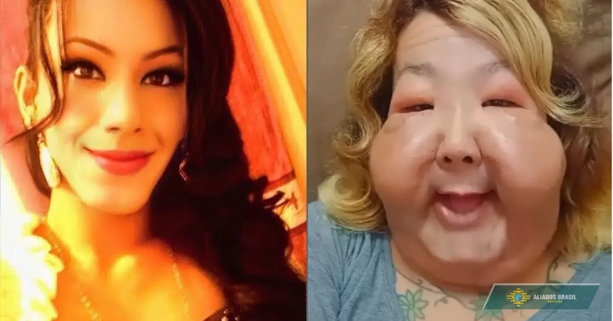 Veja como está Juju do Pix seis meses depois da reconstrução facial