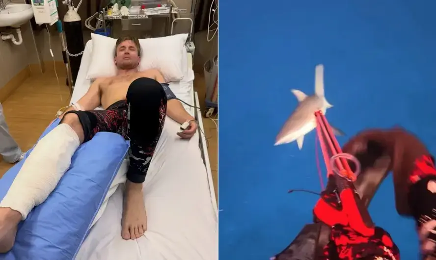 Influencer registra ataque de tubarão que sofreu durante mergulho em Fiji