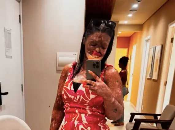 Influenciadora Karine Felipe morre aos 37 anos após luta contra doença rara