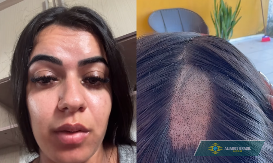 Mulher denuncia clínica após ter cabelo raspado durante exame toxicológico para CNH
