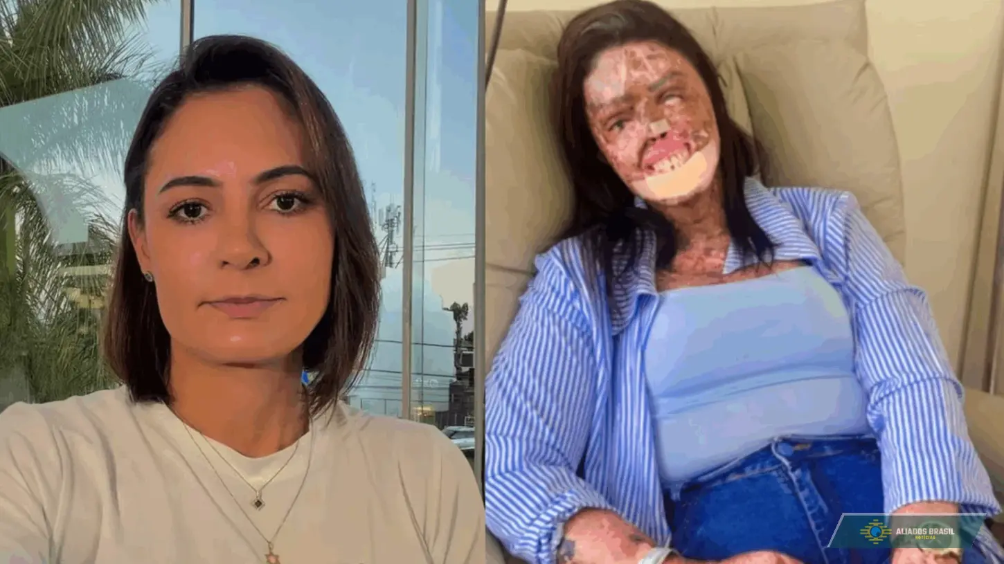 ‘Tristeza’: Michelle lamenta morte de influencer com doença rara