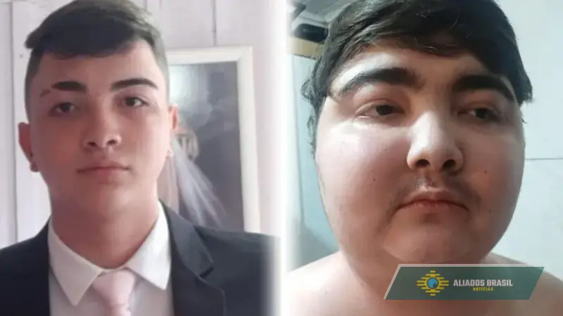Tumor com menos de 1 centímetro fez adolescente ganhar 40 quilos em 6 meses