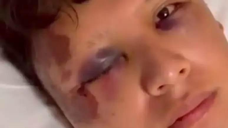 Turista mexicano é agredido com garrafada na cabeça em Copacabana 