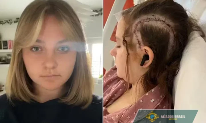 Adolescente se torna paciente mais jovem a passar por cirurgia cerebral acordada