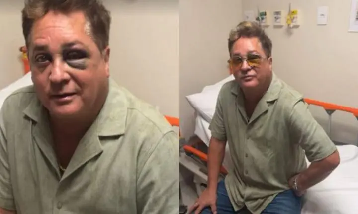 Cantor Leonardo sofre acidente e aparece com olho roxo