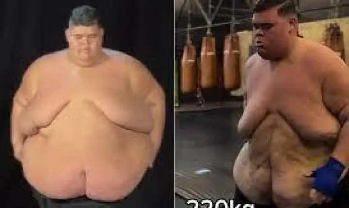 Gordão da XJ mostra antes e depois de perder 130 kg; assista e compare