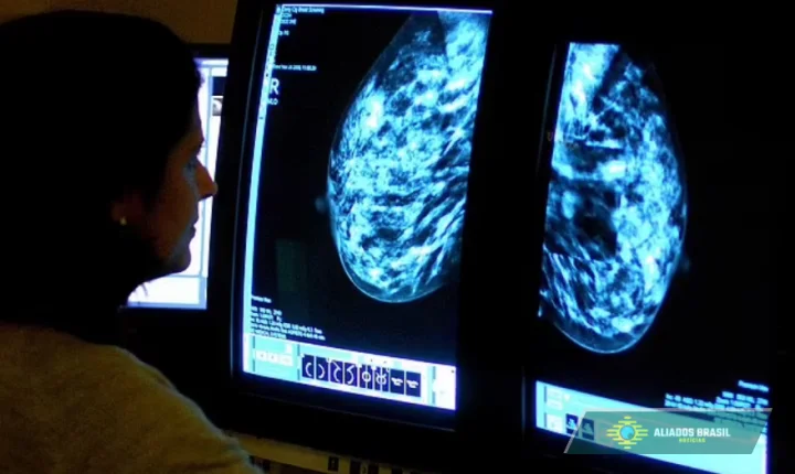 Novo remédio dobra sobrevida no câncer de mama mais agressivo