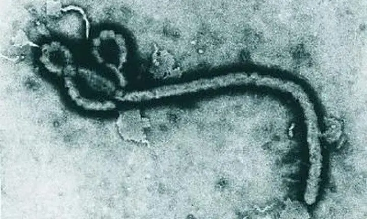 São Paulo investiga caso suspeito de Ebola em homem de 37 anos
