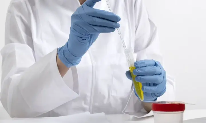 Urina com muita espuma: o que significa, quais as causas e quando pode indicar problemas nos rins